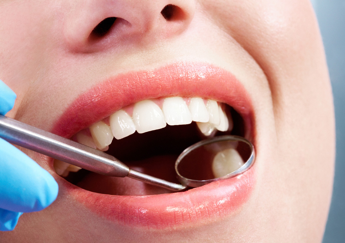 Cosmetic bonding for gaps between teeth, chips, stains, and other cosmetic issues