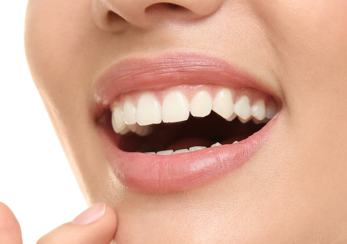 Safe Teeth Whitening in Alpharetta GA Area