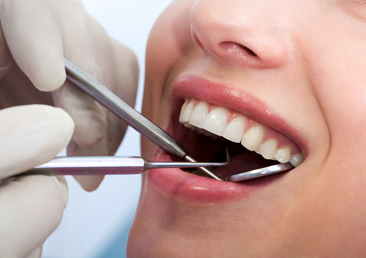 Cosmetic Fillings Front Teeth in Alpharetta GA Area