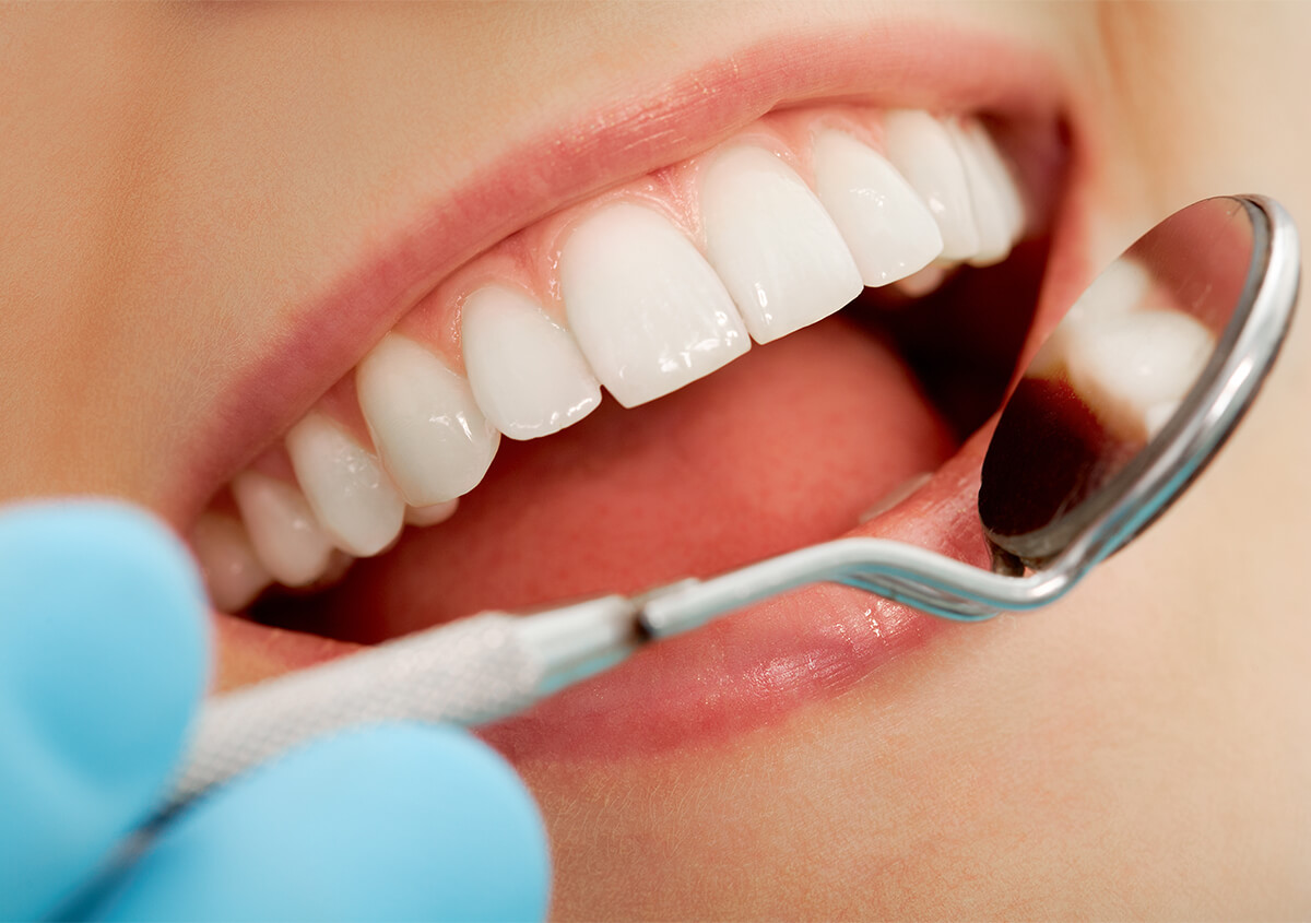 Teeth Cleaning Services in Alpharetta GA Area
