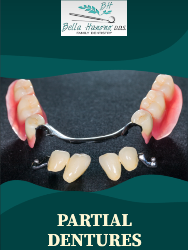 Factors to consider when choosing partial dentures