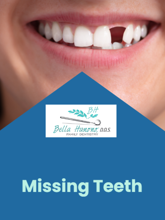 Missing teeth should not be ignored.